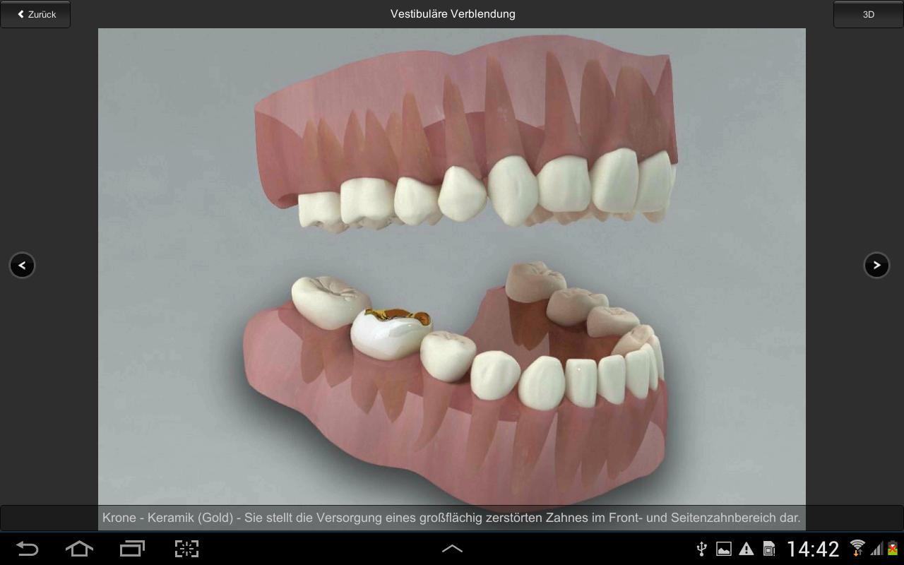 CGM VISODENT 3D App