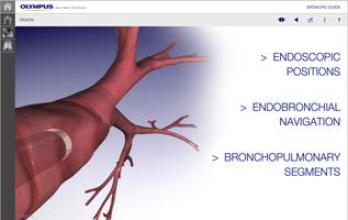 BronchoGuide